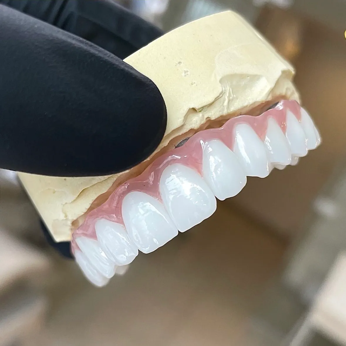 Gentle rolling hills with dry grass under soft lighting, showing contrast between light and shadow.