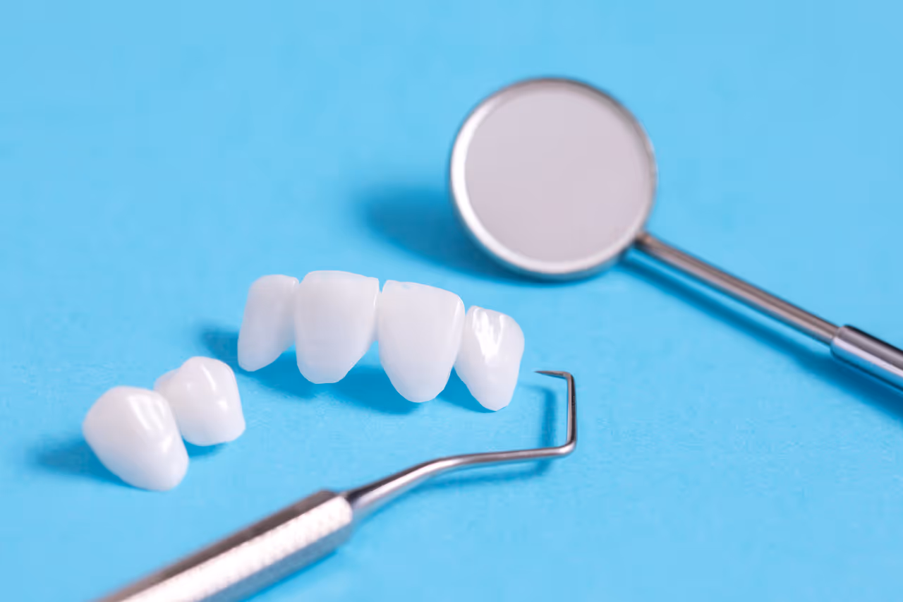 How Long Do Porcelain Veneers Typically Last Before Needing Replacement?