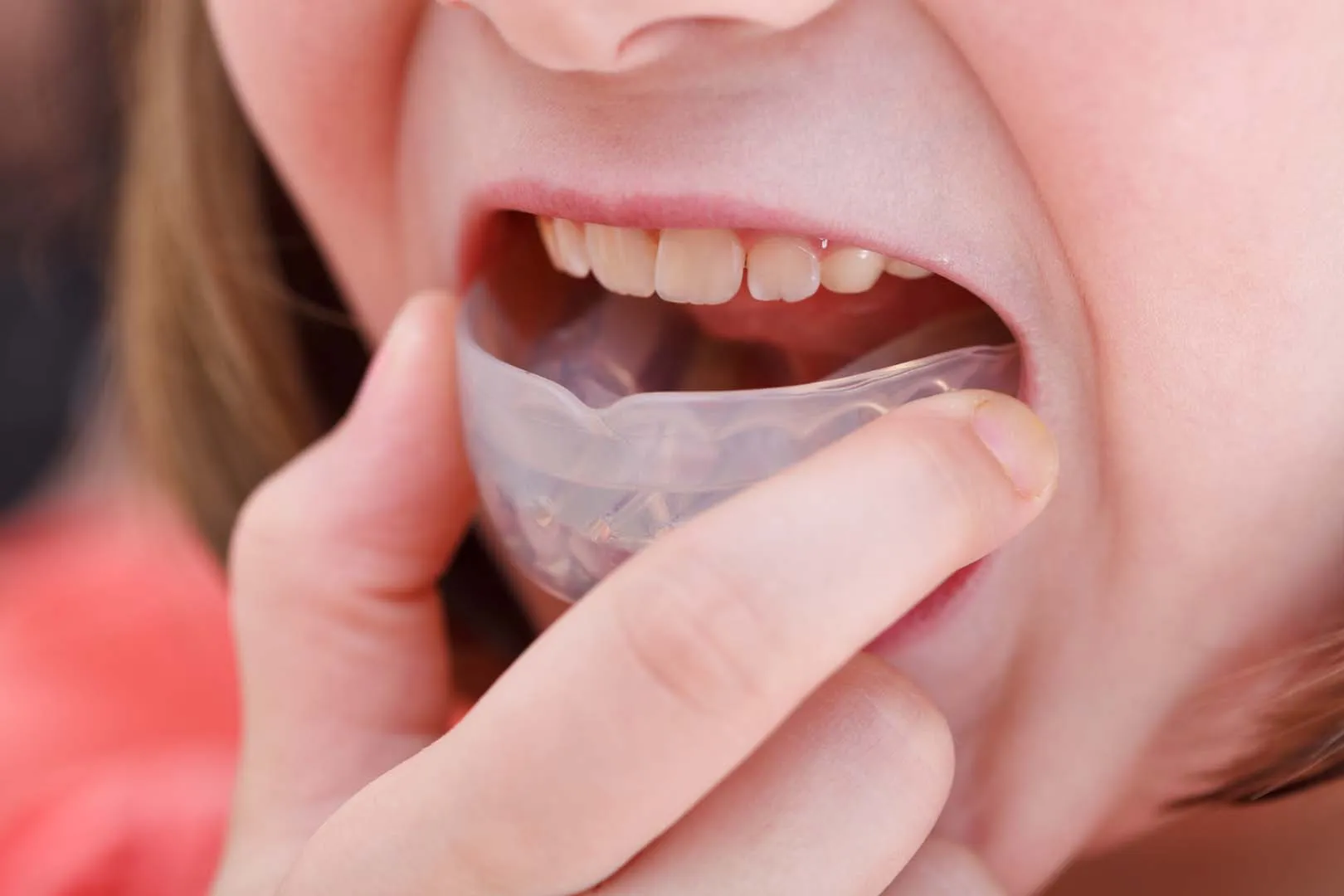 Occlusal & Sports Guards