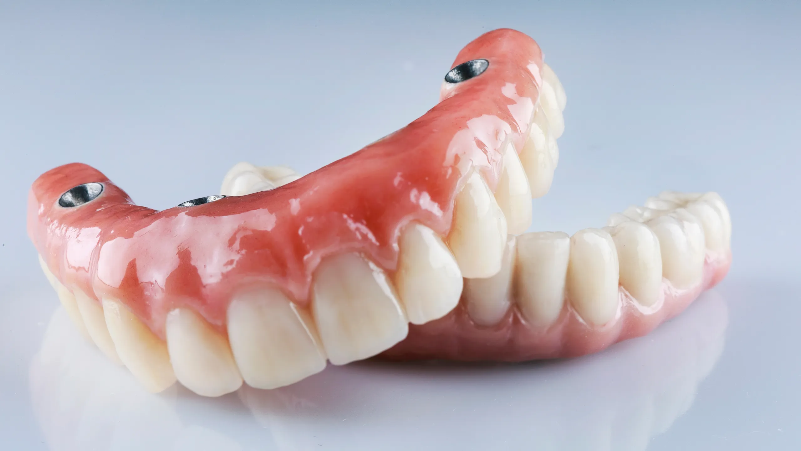 Implant-Supported Dentures & Overdentures