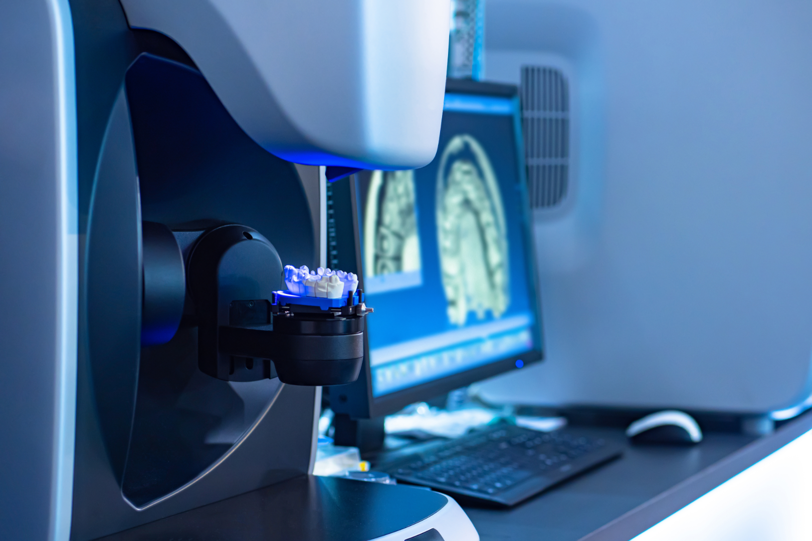 Dental 3D scanner scanning dental mold with dental arch images on computer screen in background.