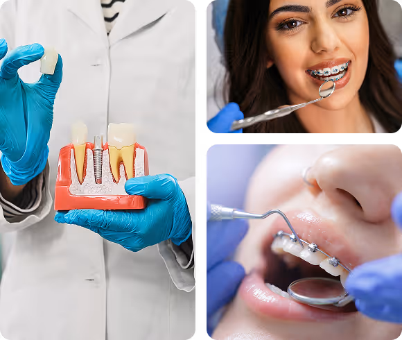 Dentist holding dental implant model, woman with braces, and close-up of braces adjustment.