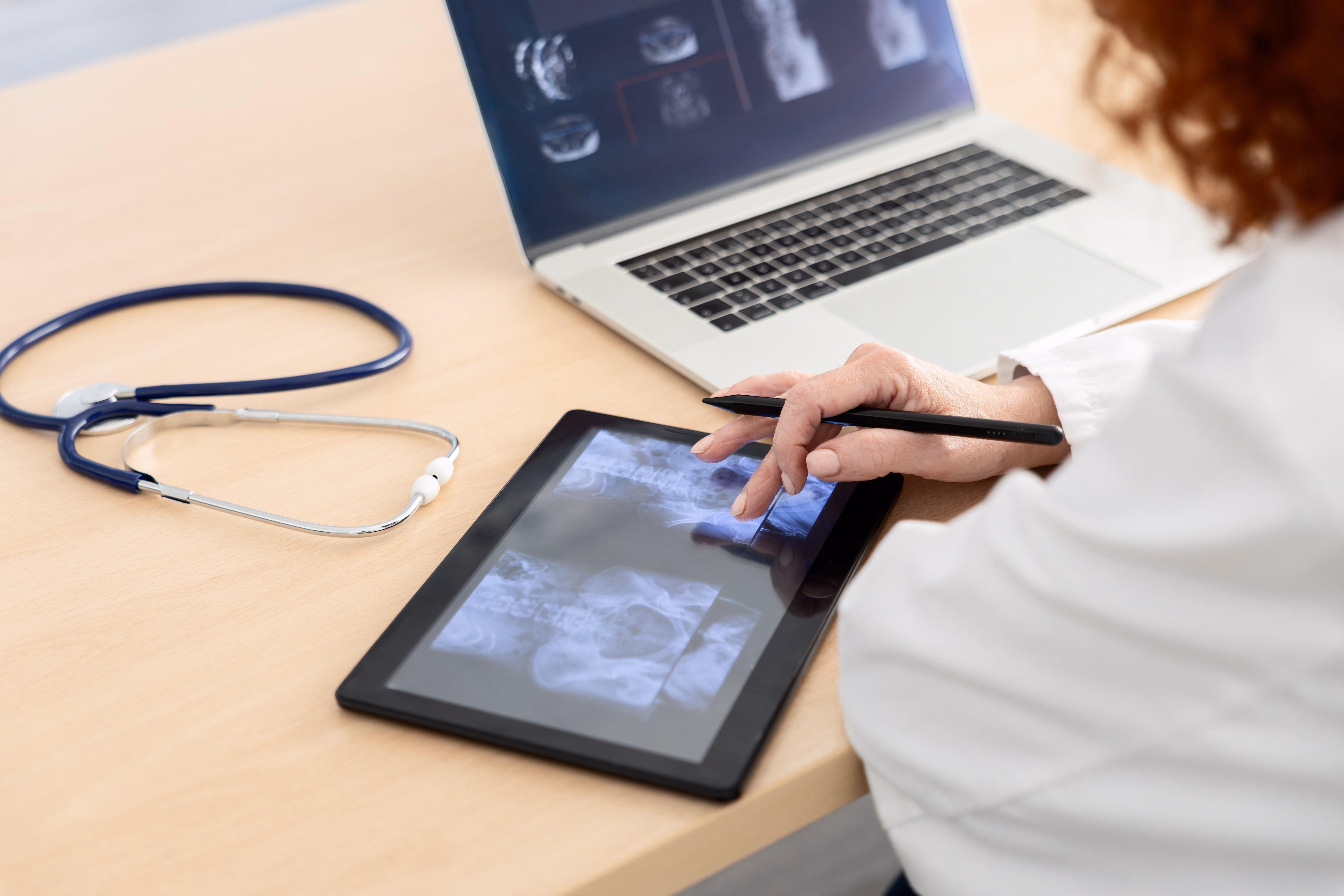 Medical professional pointing at spinal X-ray on tablet near laptop and stethoscope on desk.