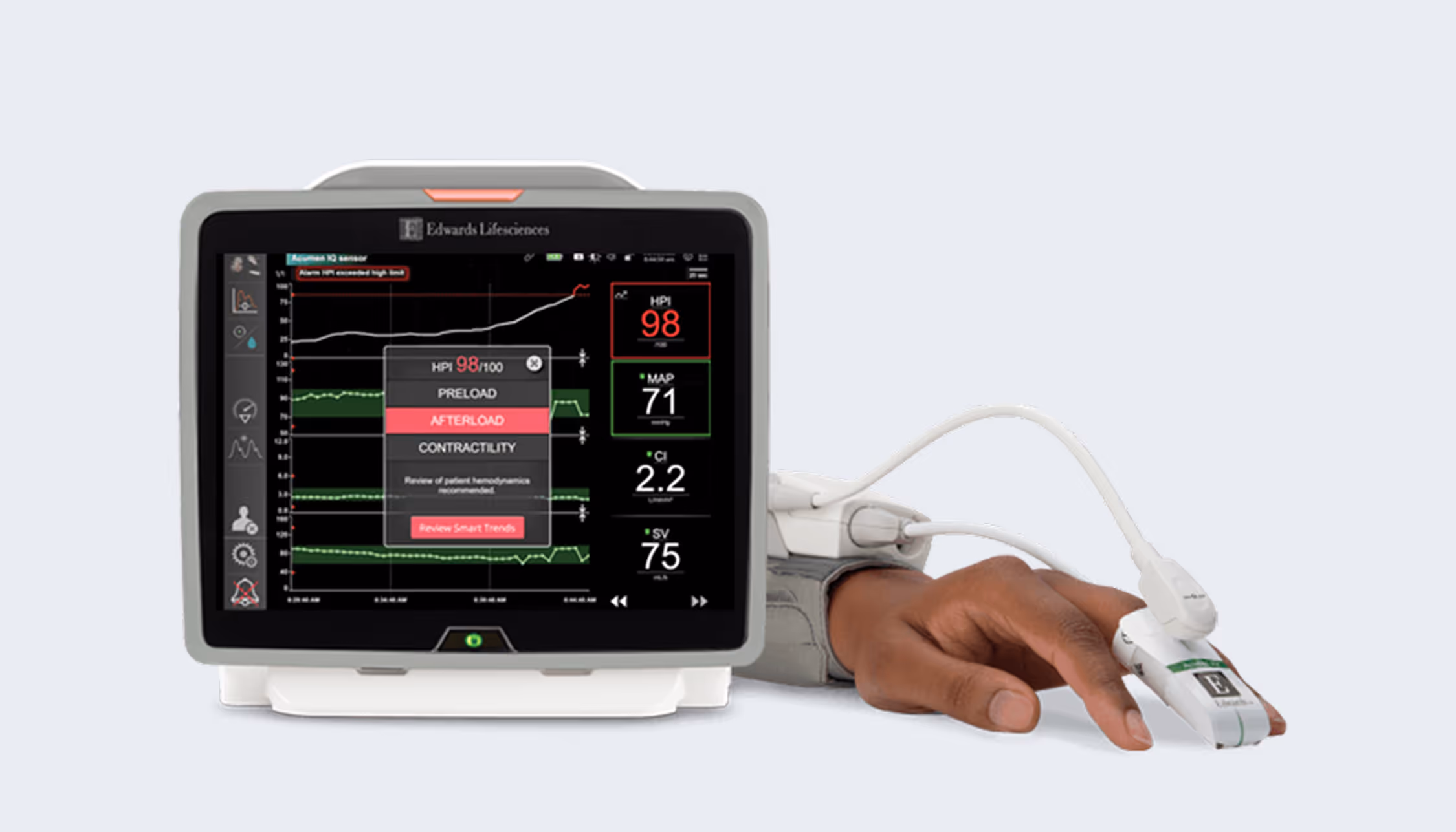 Medical monitor screen showing vital signs and data with sensor clipped to a person's finger.