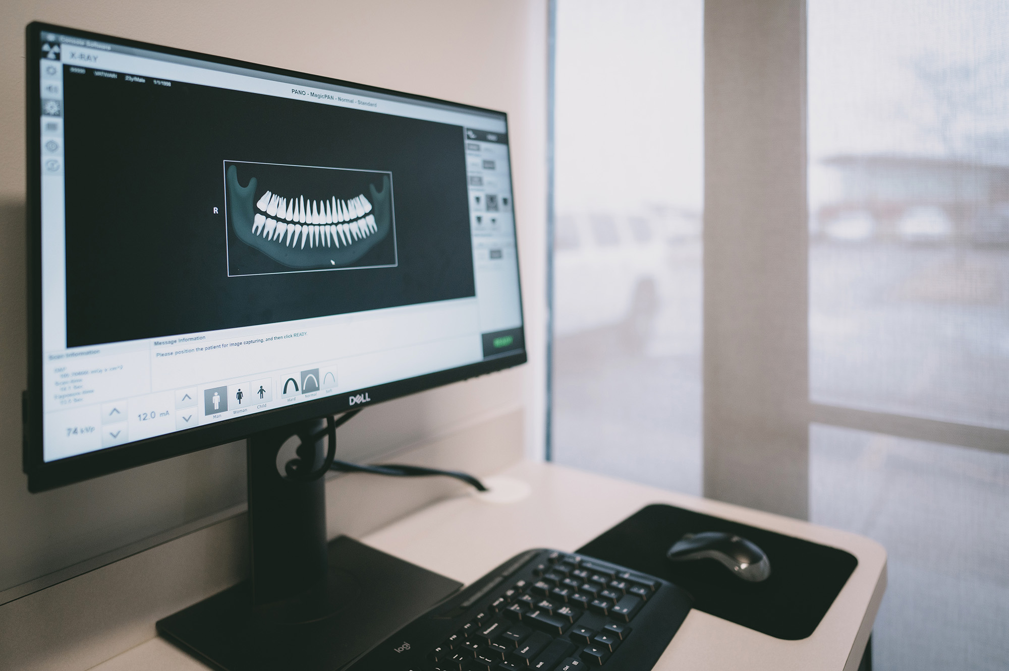 Computer monitor displaying a digital dental X-ray image of teeth on a desk with a keyboard and mouse.