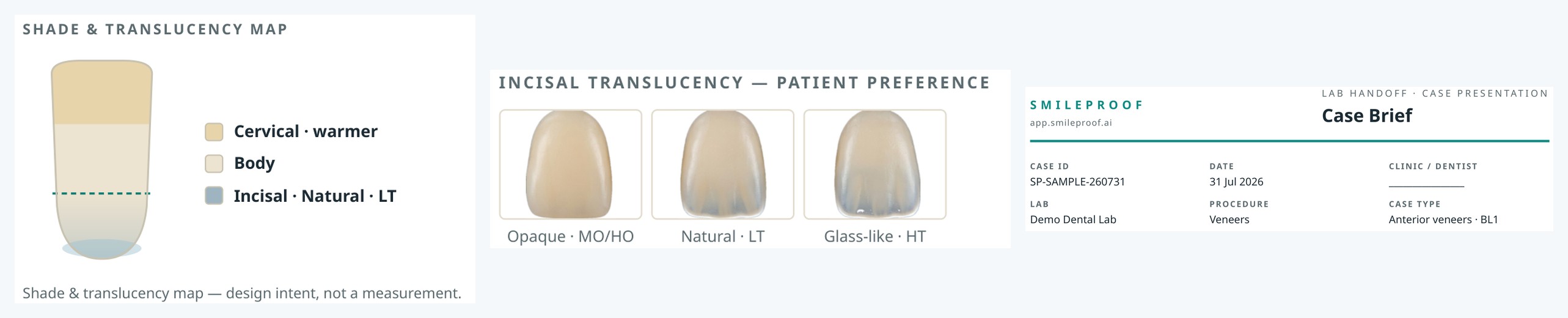 Three crops from the lab report: shade and translucency map, incisal translucency choices, and the branded case-brief masthead