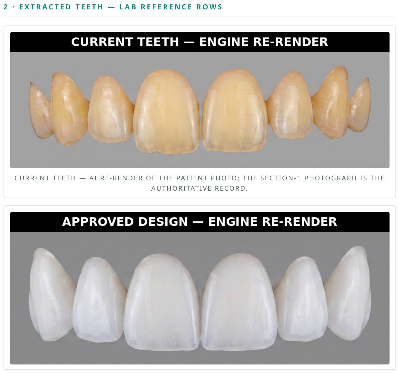 Lab report page: the patient's current teeth re-rendered above the approved simulated design