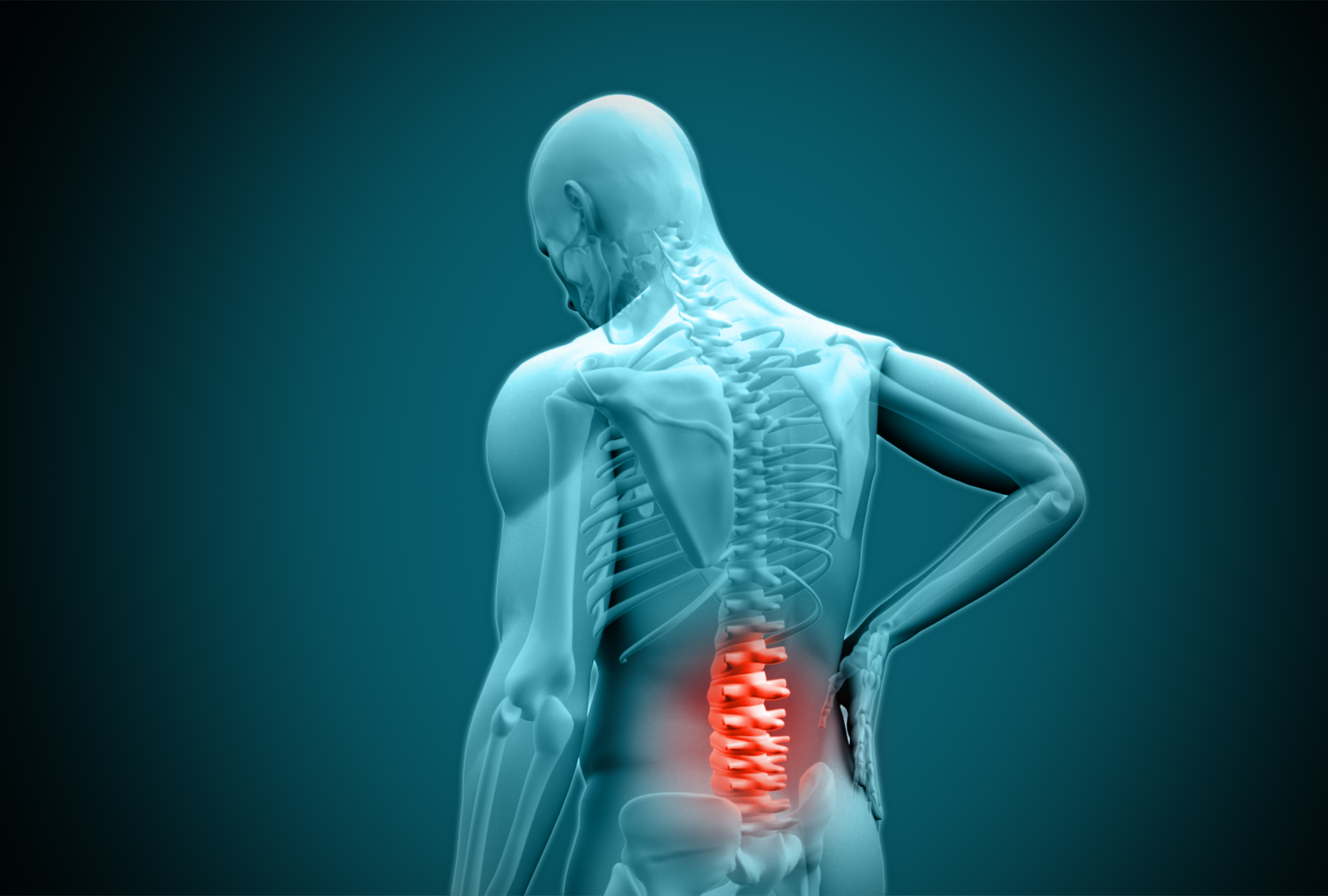 Illustration of the lumbar spine, the site of chronic low back pain