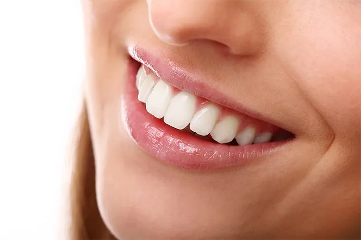 como-corregir-la-sonrisa-gingival
