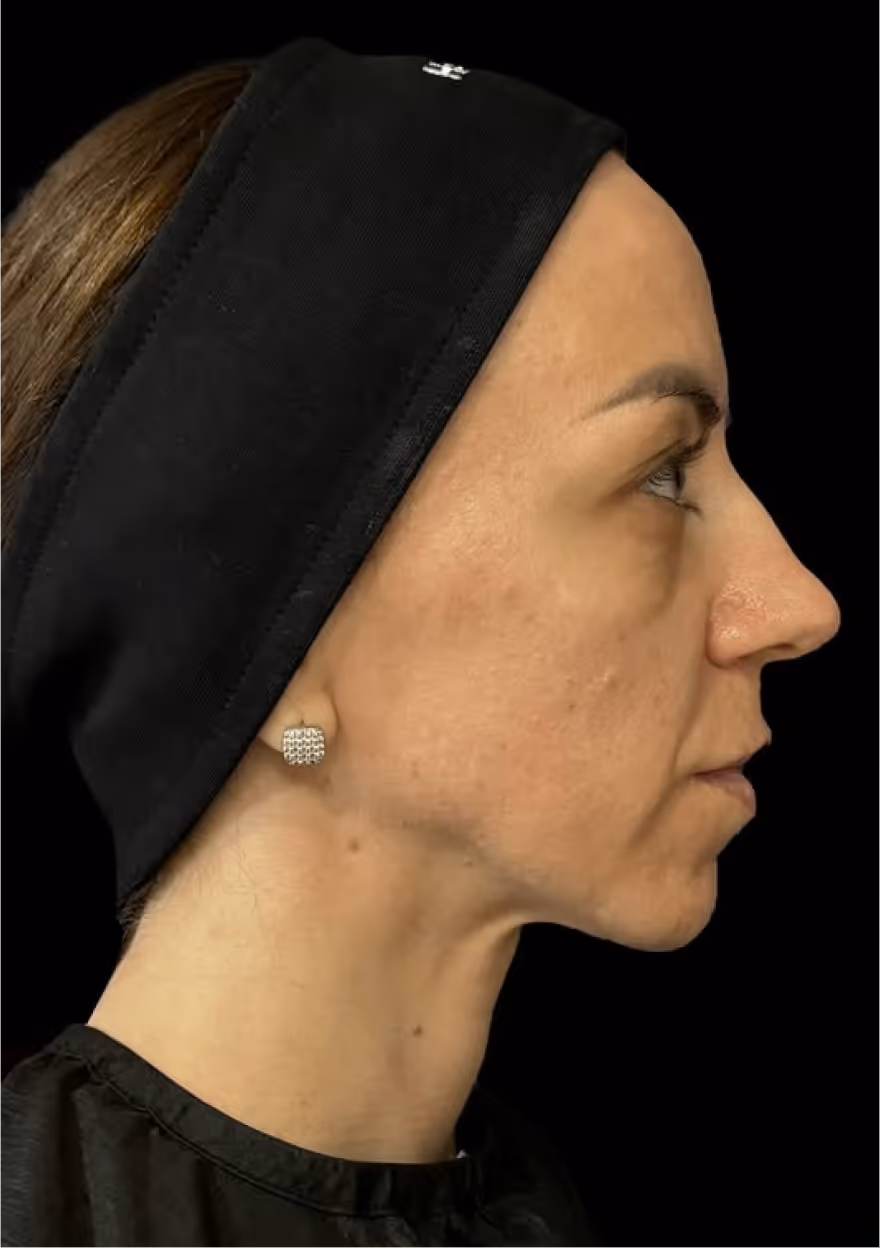 Close-up of a woman with light skin, blue eyes, wearing a black headscarf and stud earrings.