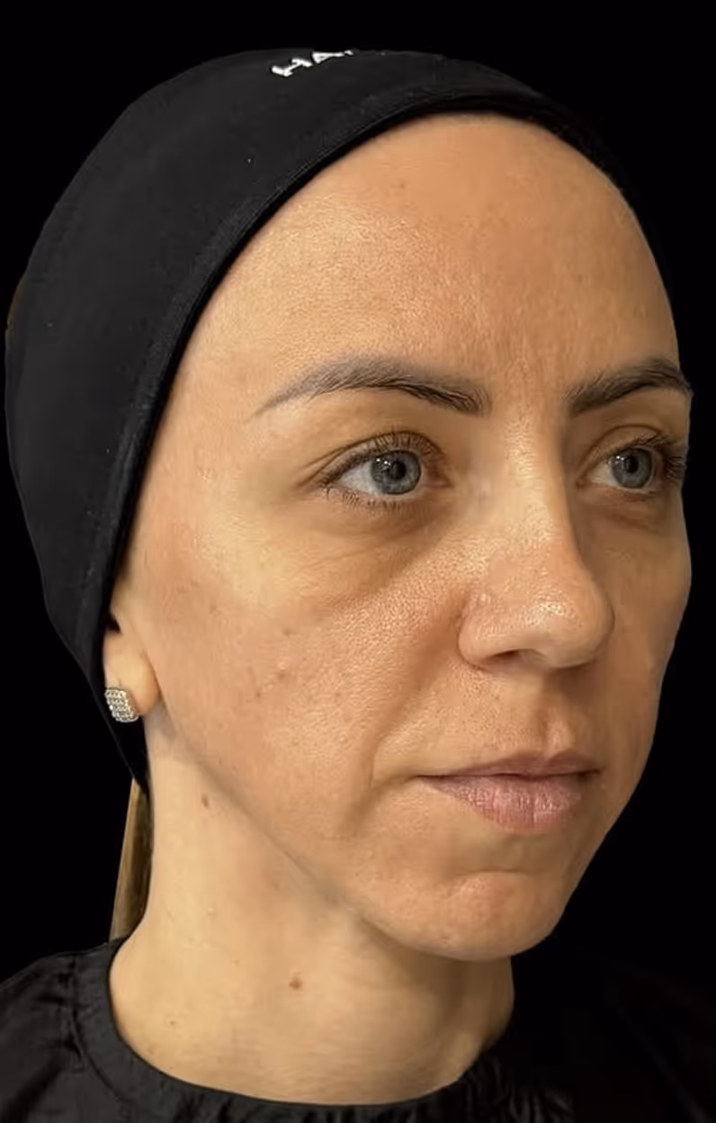 Close-up of a woman with light skin, blue eyes, wearing a black headscarf and stud earrings.