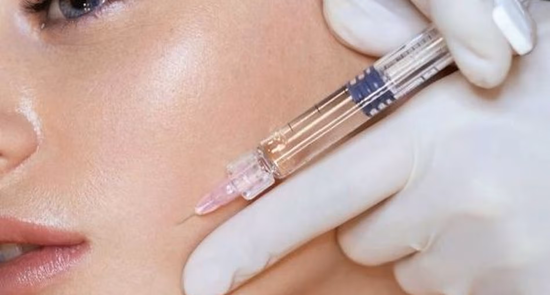 Gloved hand holding syringe injecting clear liquid into a person's cheek near lips.
