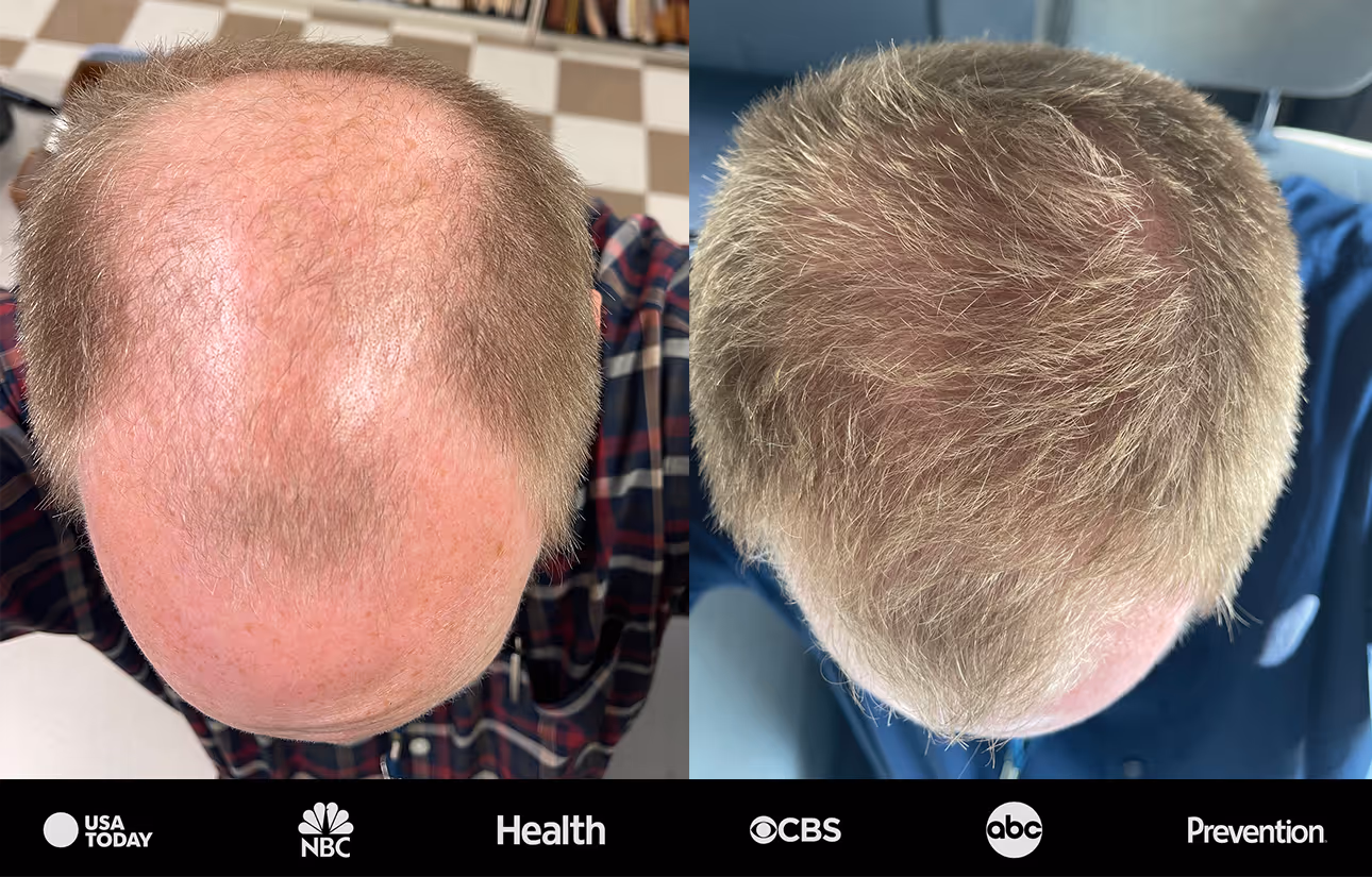Happy Head Topical SuperSolution ProBlend