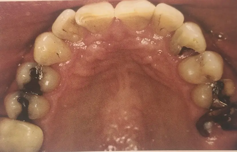 Before Image