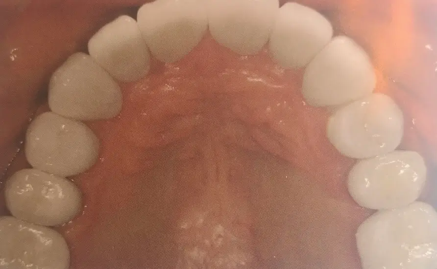After Image