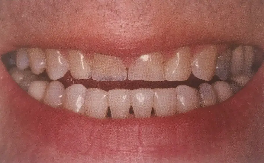 Before Image