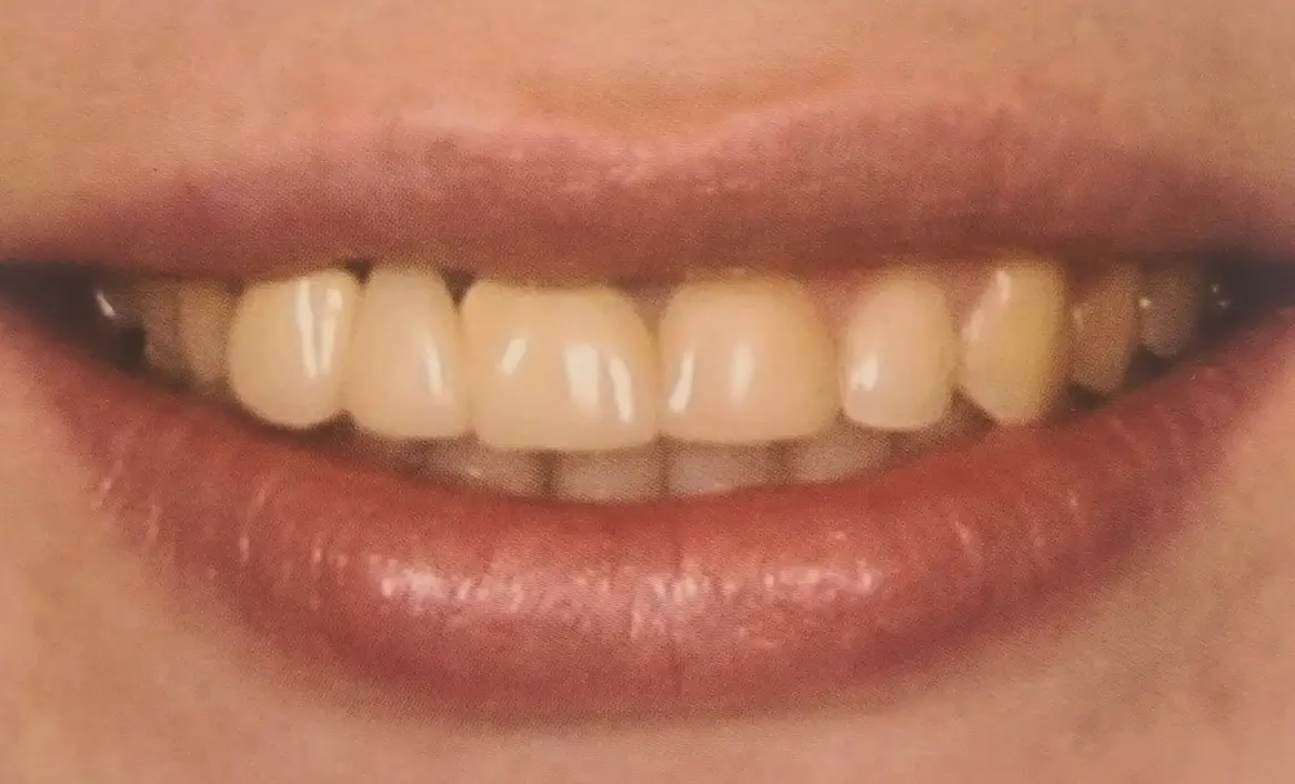 Before Image