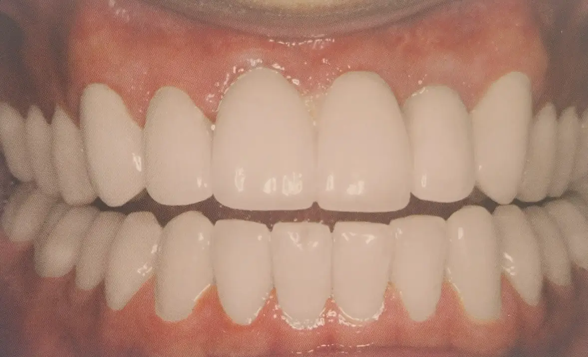 After Image
