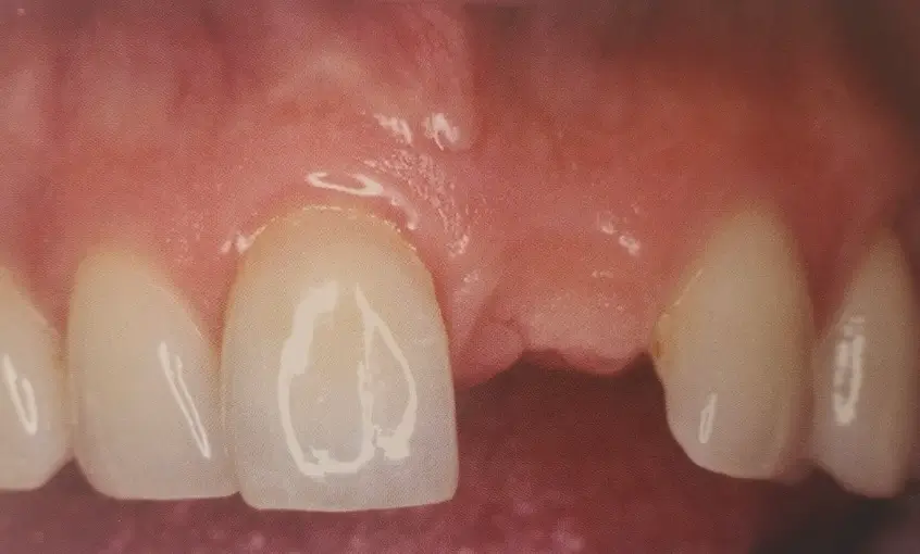 Before Image