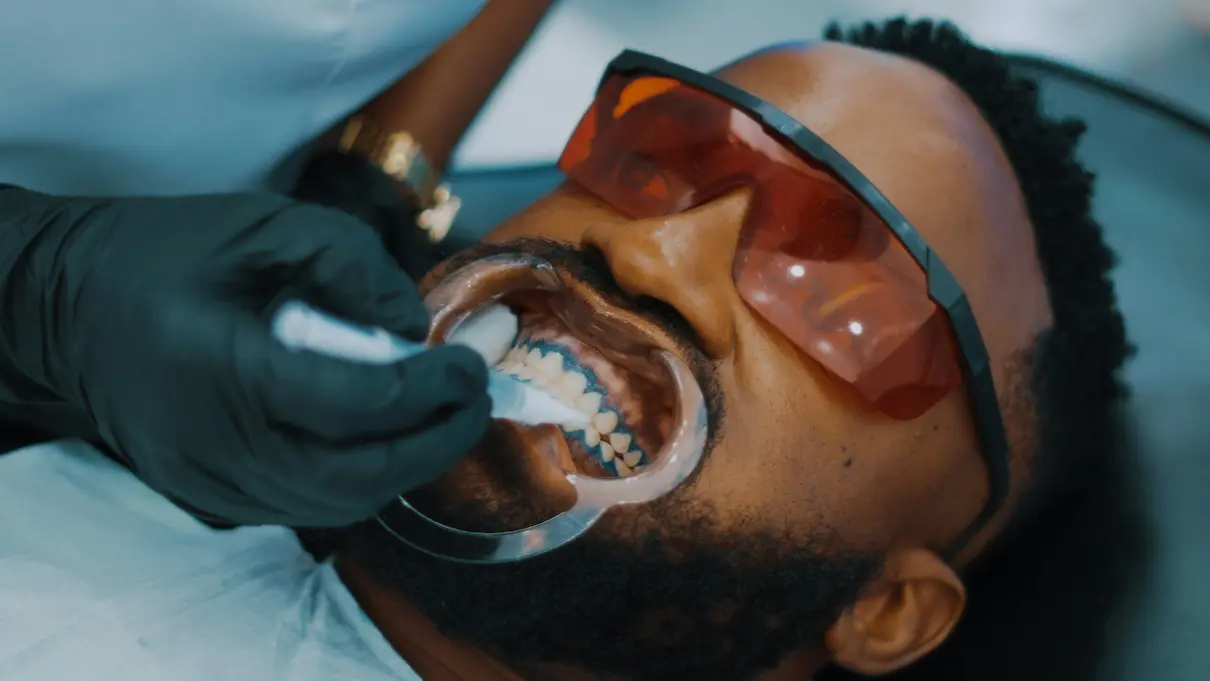 Man wearing protective glasses receiving dental treatment with a mouth retractor and blue-tinted gel.