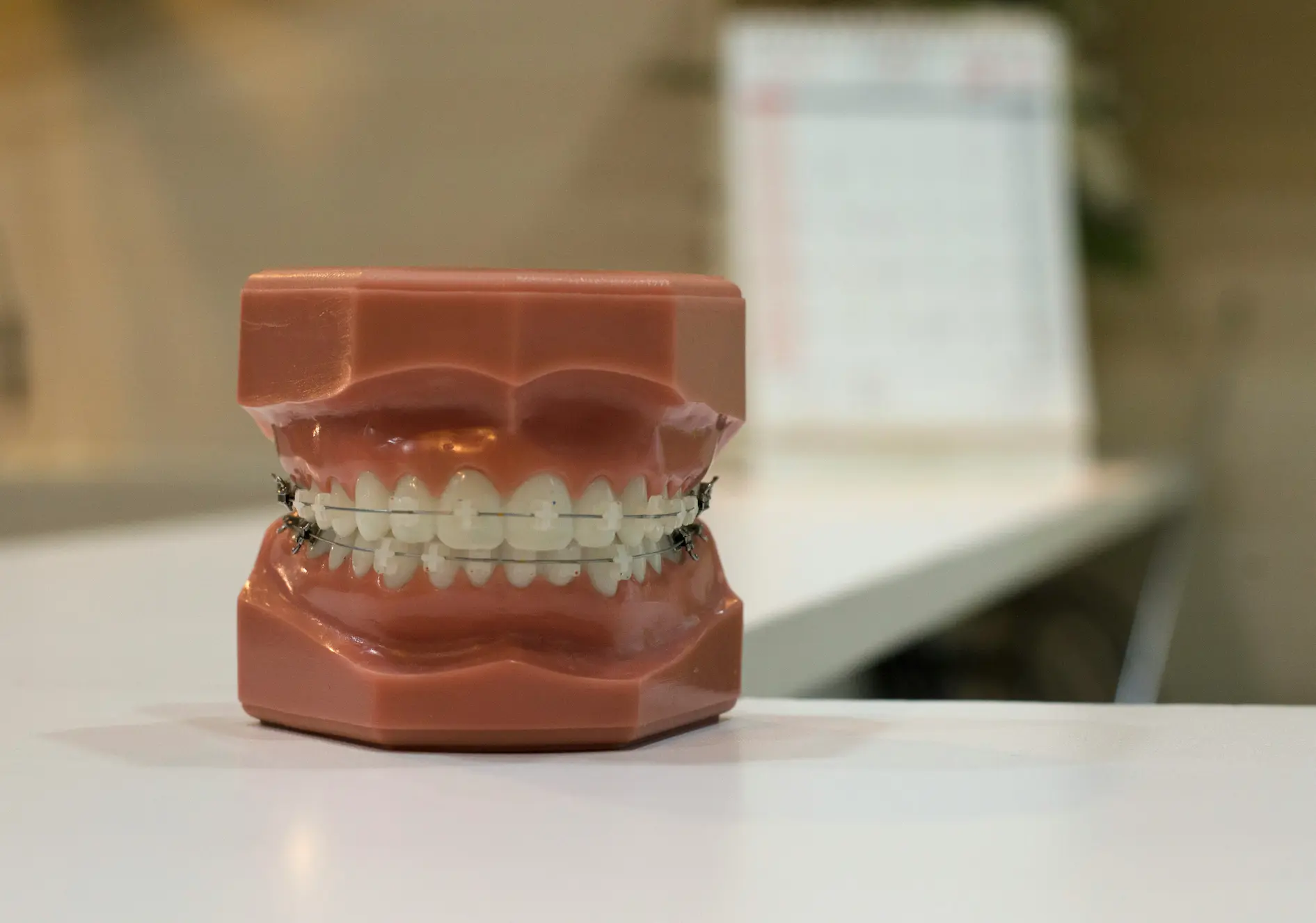 Orthodontic dental model showing white teeth fitted with clear braces and metal wires.
