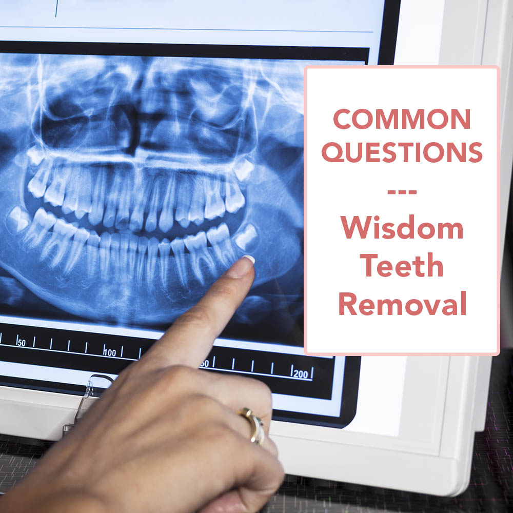 Common Question about Wisdom Tooth Removal Procedure