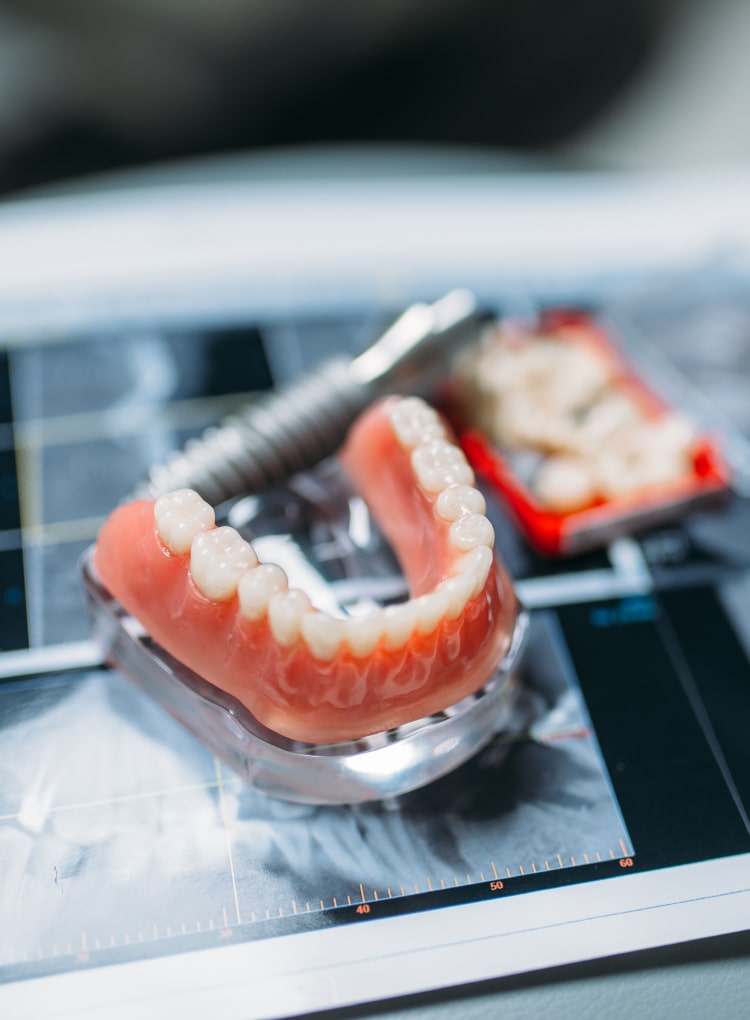 Dentures Toronto