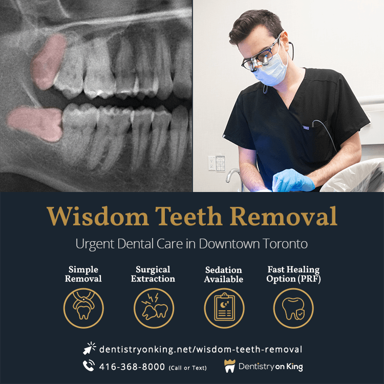 Wisdom Teeth Removal