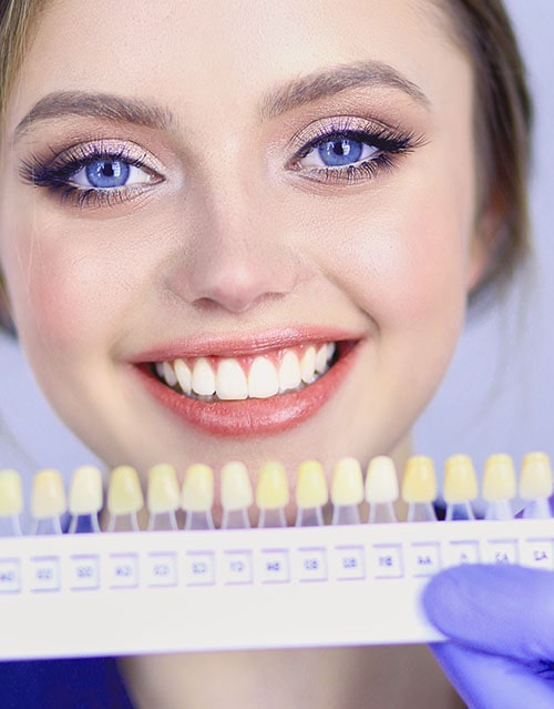 Dental Veneers in Toronto