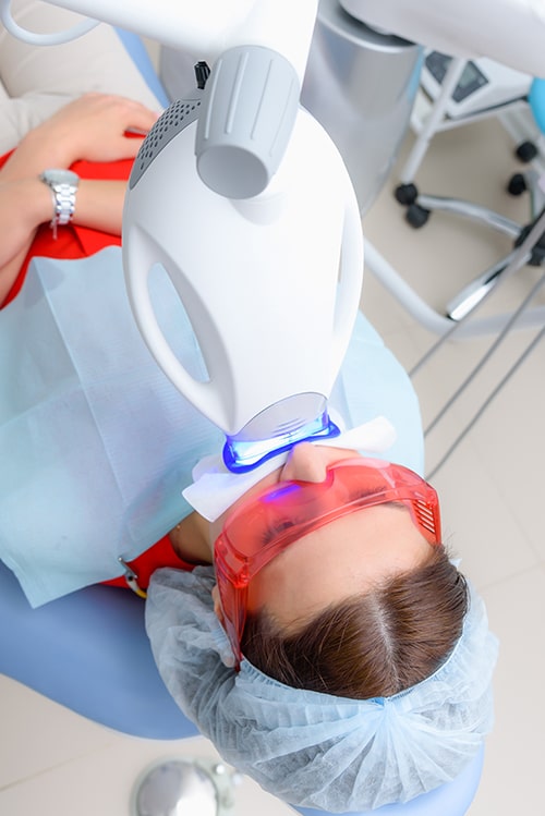 Teeth Whitening in Downtown Toronto