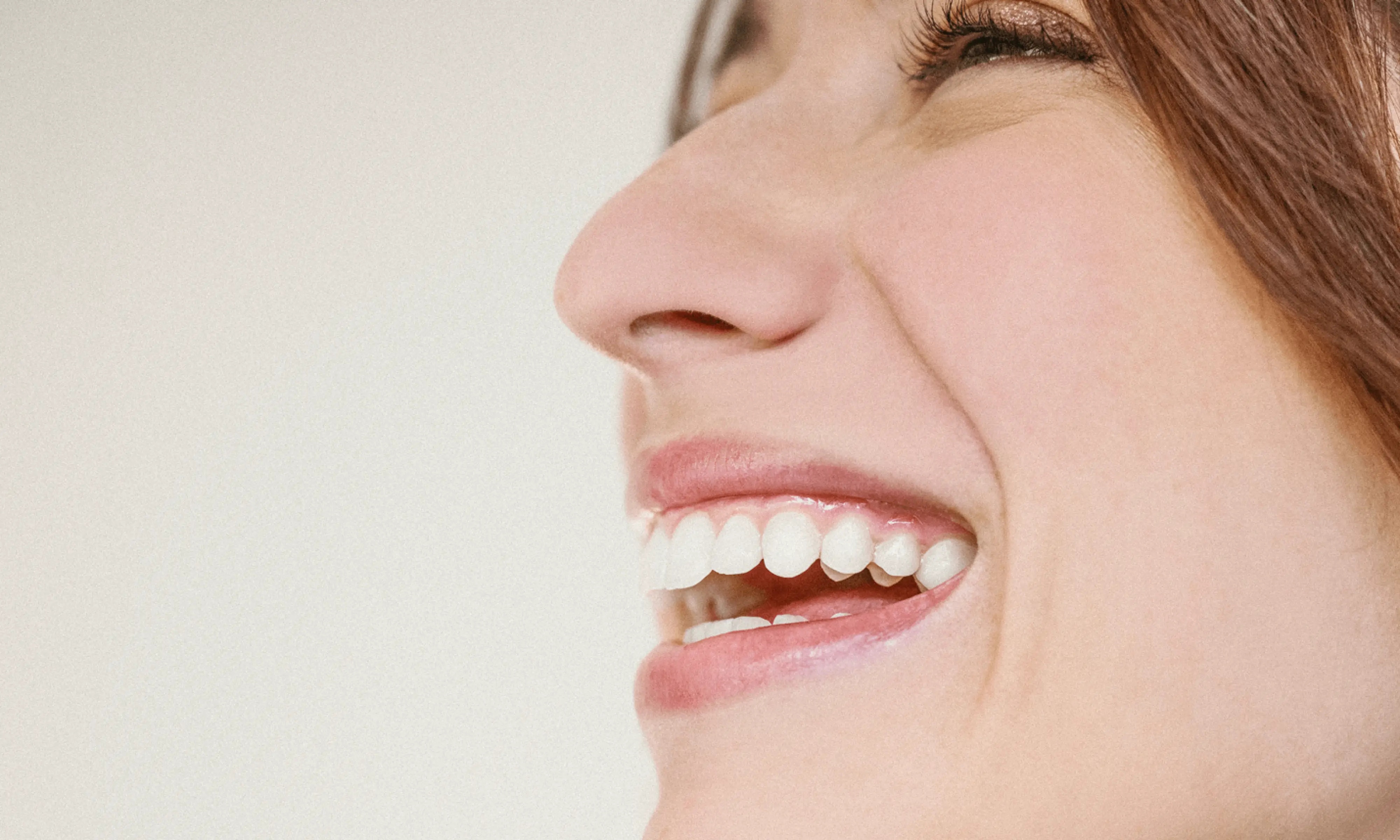 Transform your smile: expert hygienist treatments in Wandsworth