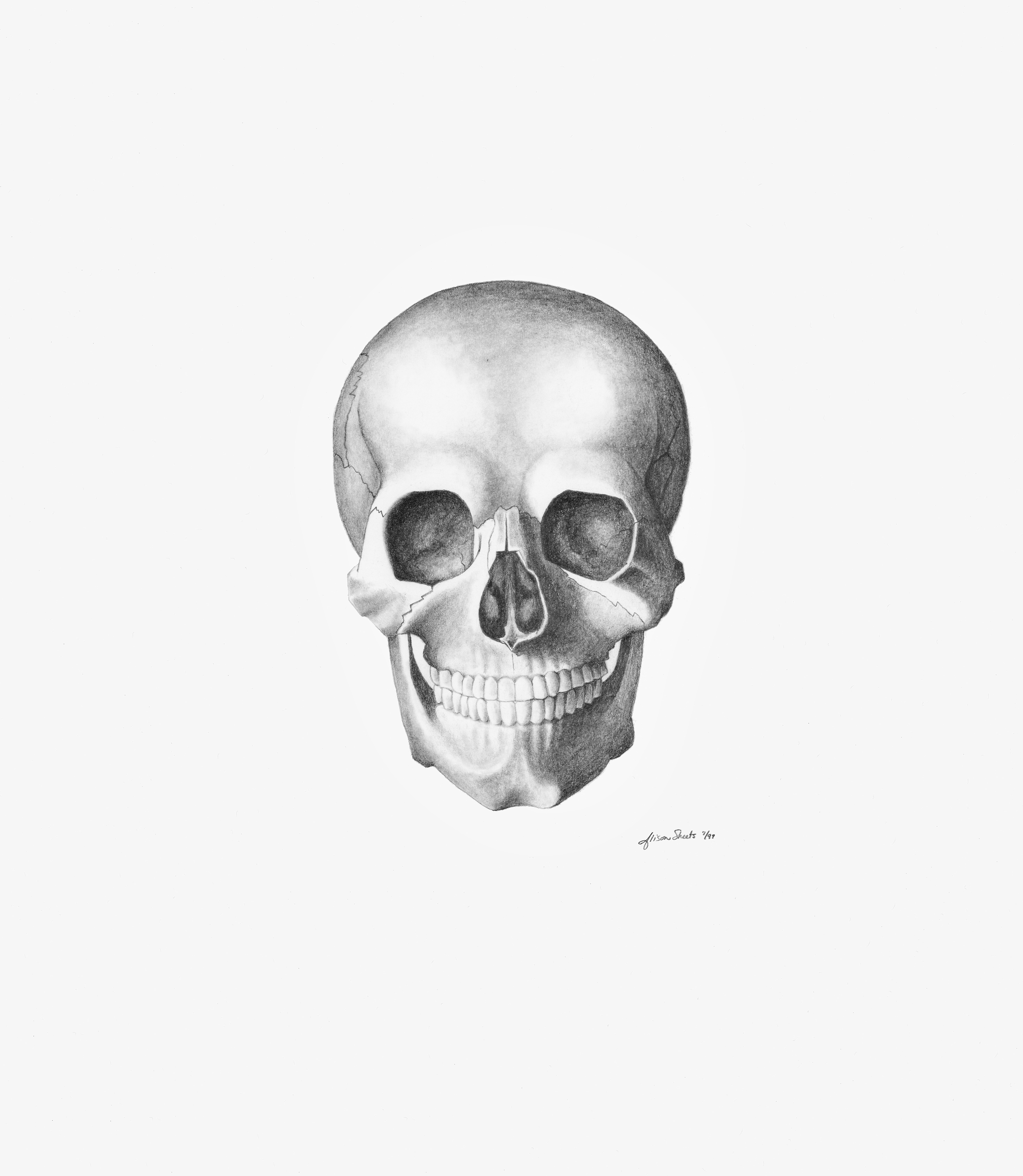 Study IV
