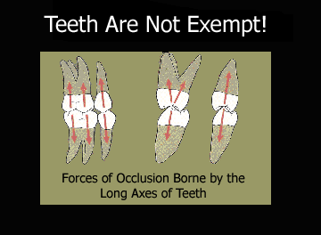 forces-of-occlusion