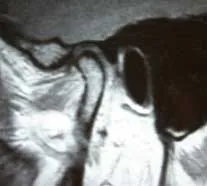 joint-fig7