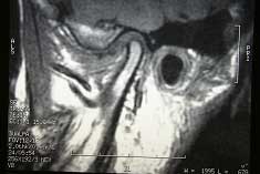 joint-fig9