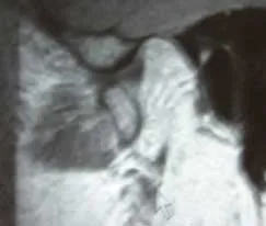 joint-fig8