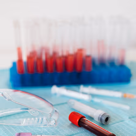 Laboratory scene with test tubes of blood in a blue rack, syringes, and protective goggles on a surface.