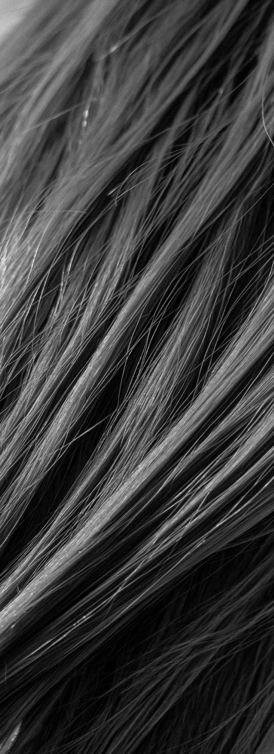 Thinning hair representing PRF Hair Restoration Portland Maine