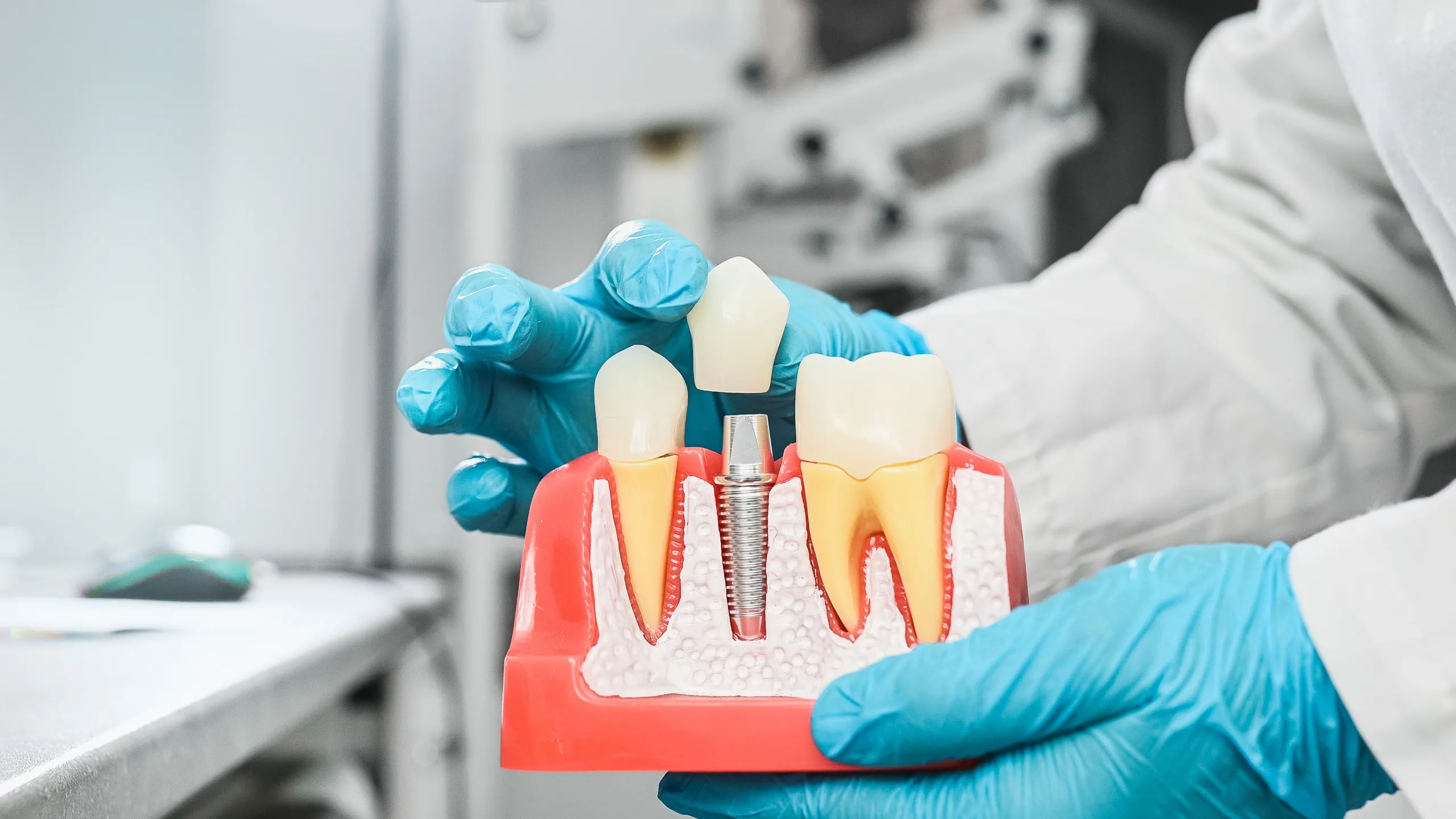 Mini Dental Implants
