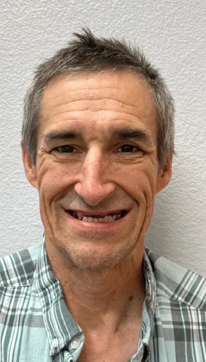 Man smiling before dental treatment with several missing front teeth against a light gray background