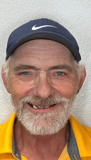 Man smiling before dental treatment with several missing lower front teeth wearing a navy cap against a light gray background