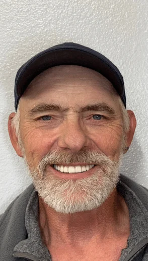 Man smiling after dental treatment with a full bright smile wearing a navy cap against a light gray background