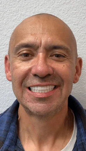 Patient displaying an even natural looking smile following restorative dental care