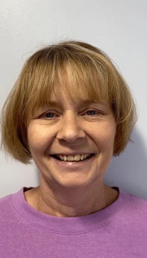 Woman smiling with visible gaps in the upper teeth during a dental smile assessment