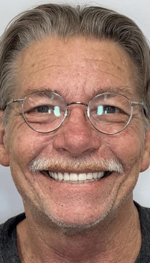 Man smiling confidently with an even healthy looking smile following comprehensive dental restoration while wearing round eyeglasses