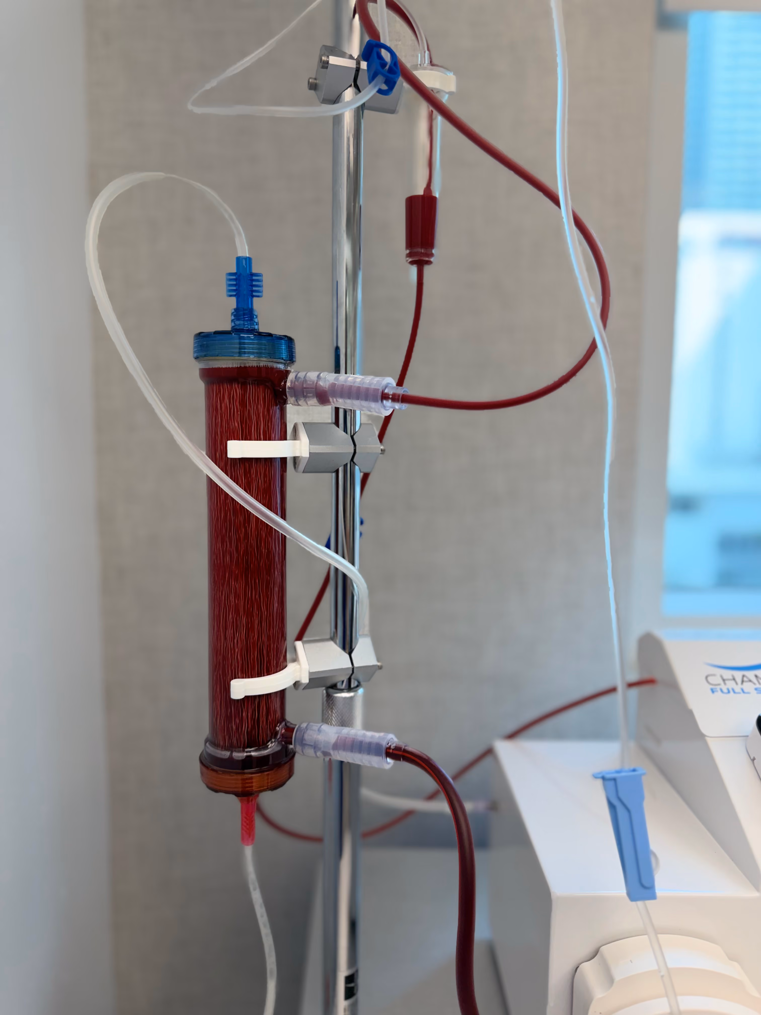 Close-up of the EBOO filter cartridge and blood tubing on the treatment machine at Nexsis BioHealth
