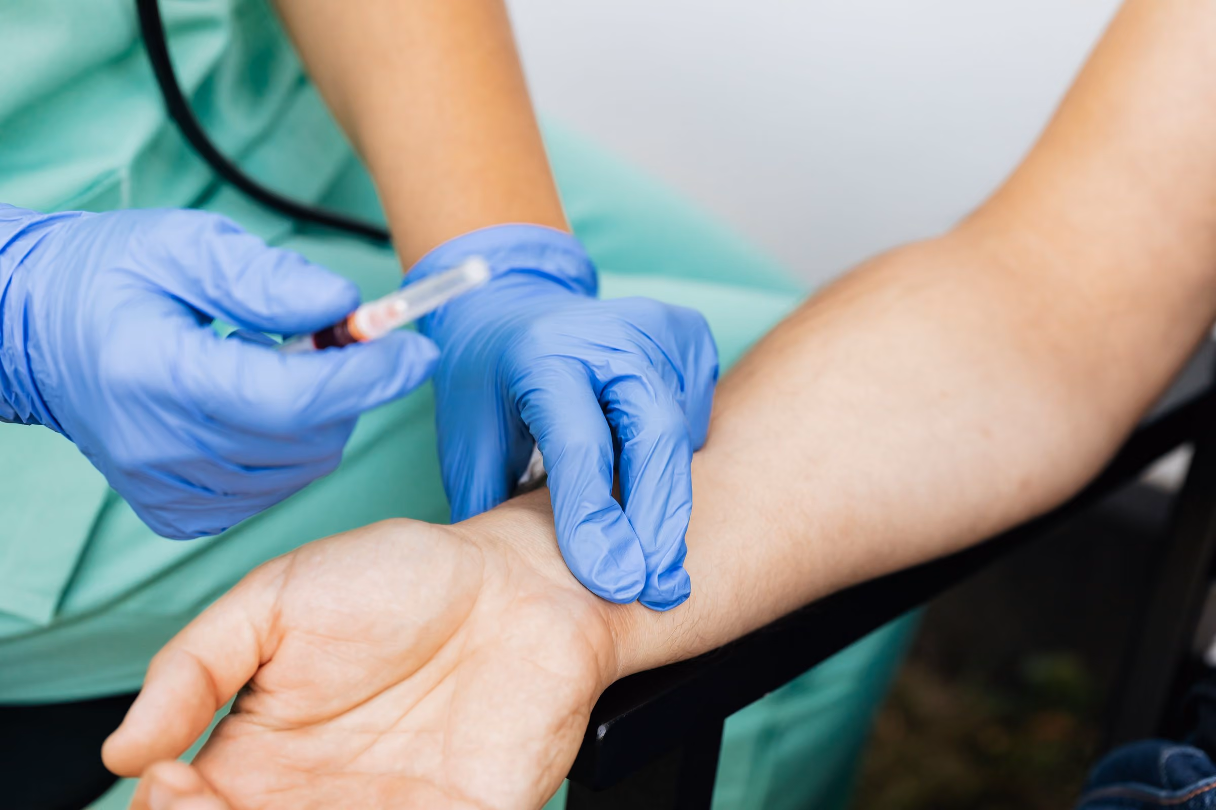 Nurse drawing a blood sample for allergy testing