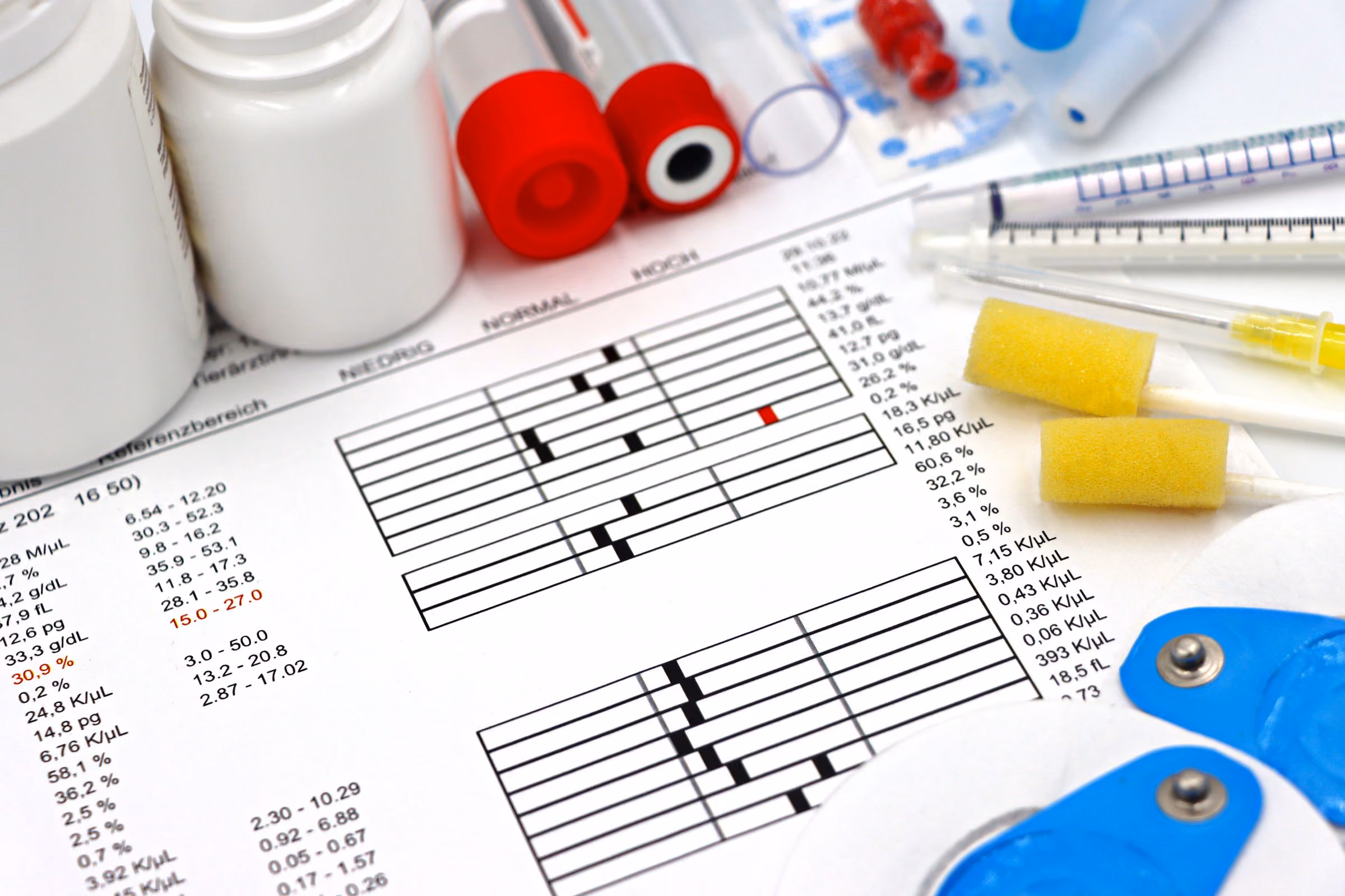 Allergy blood test results with sample tubes