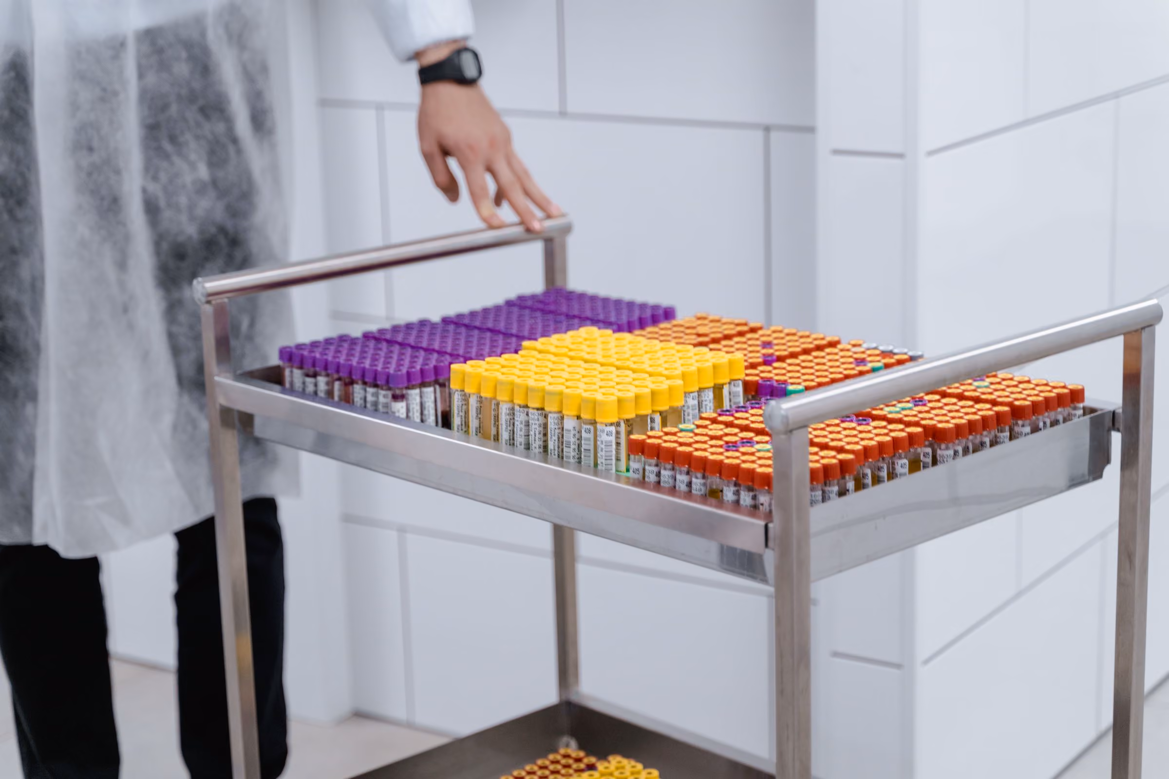 Colour-coded sample tubes in an allergy testing lab