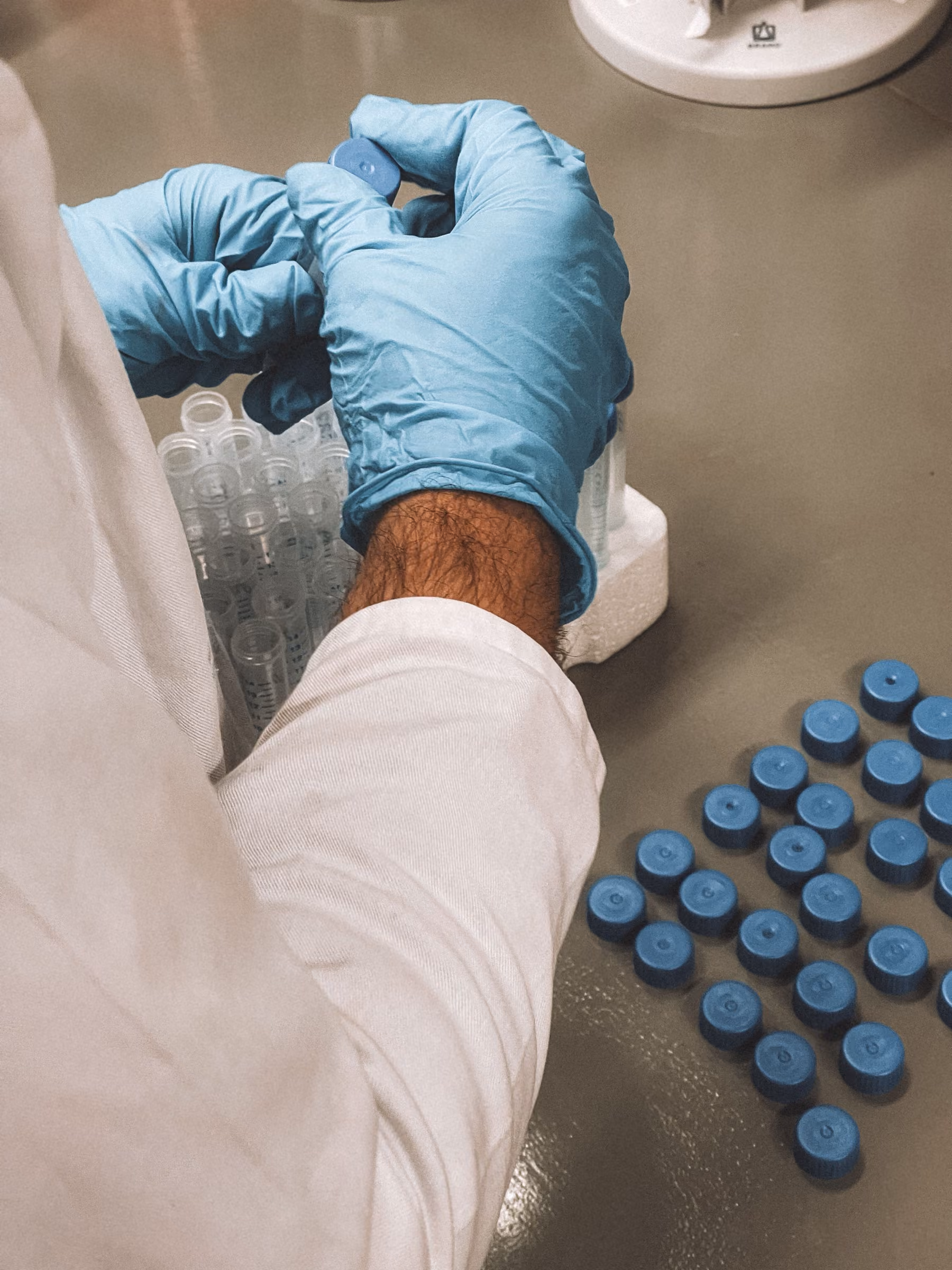 Researcher preparing samples in an allergy testing lab